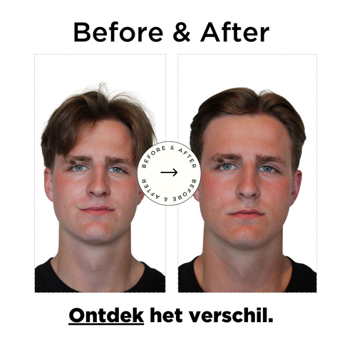 Haar Clay Before After